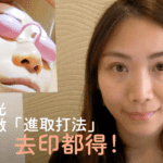 真人挑戰！皮秒激光3-4次K.O色斑 Beverly Channel - Beverly Skin Refining Center