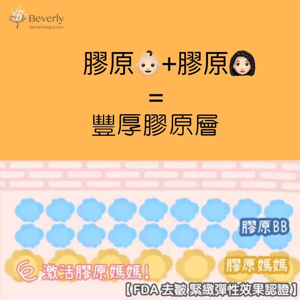 「膠原增生新角度 年輕種子始於膠原媽媽」-Beverly Channel