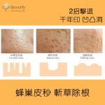 皮秒PICO LASER 3去凹凸洞暗瘡印有效嗎？｜推介755蜂巢皮秒激光2021｜Beverly Skin Refining Center hk