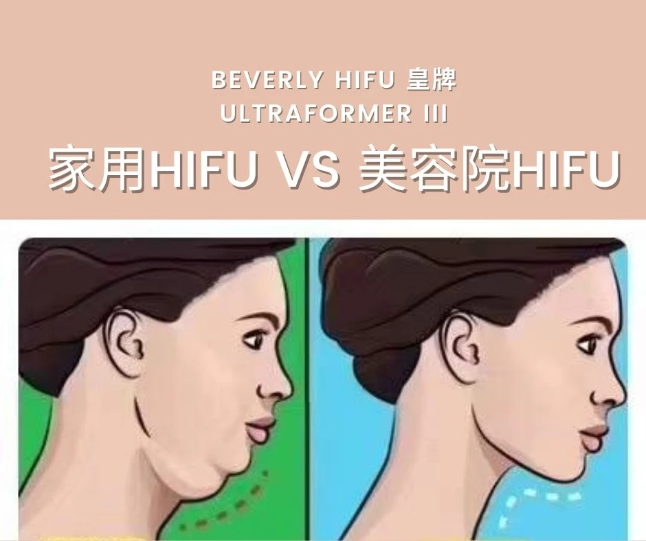 HIFU療程不退潮流︳無創瘦面緊緻提升