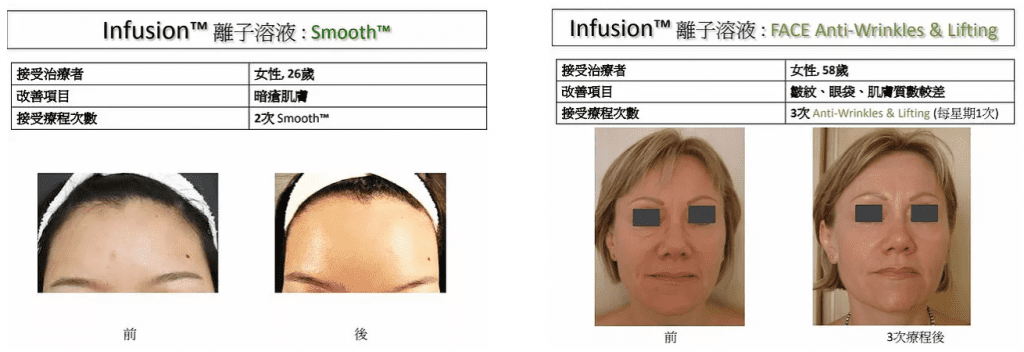 Infusion細胞激活