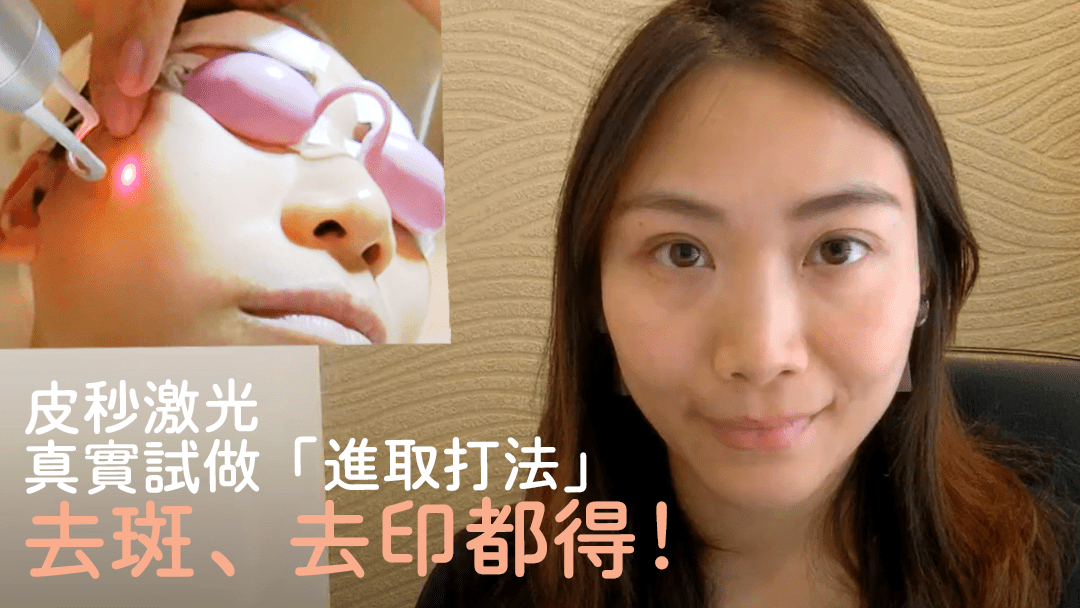 真人挑戰！皮秒激光3-4次K.O色斑 Beverly Channel - Beverly Skin Refining Center