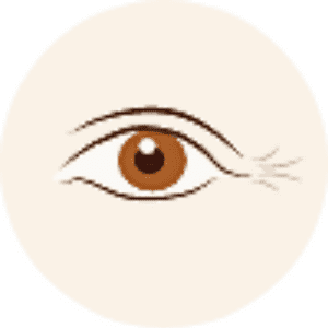 2023 BTL Exilis Ultra 360眼袋槍眼部+額頭