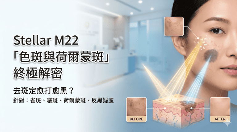 Stellar M22 的「色斑與荷爾蒙斑」終極解密：去斑定愈打愈黑？