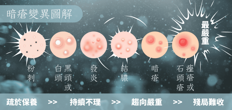 重度果酸煥膚療程 - Beverly Skin