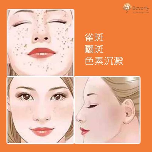 pico 皮秒 皮秒激光幾耐做一次 激光去斑邊間好 pico價錢 pico 打斑 pico 皮秒激光 皮秒激光價錢 皮 秒 去 斑 邊 間 好 皮秒 去斑 皮秒激光去斑