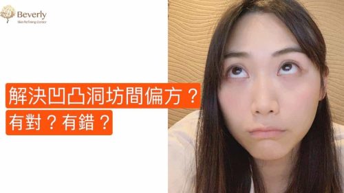 解決凹凸洞一問一答-Beverly Channel