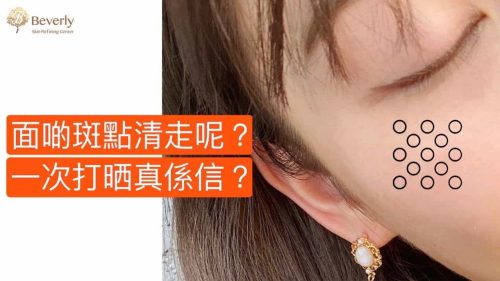 超speed K.O色斑 詳盡版講殲滅色素上集